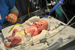 Premature baby girl in an Neonatal ICU bed.
