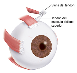 Vista de tres cuartos del ojo en donde se observan los músculos del ojo.