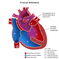Anatomía de un corazón con conducto con tronco arterial