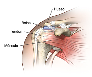 Vista frontal de un hombro donde se observan los huesos, los ligamentos, los tendones y la bolsa sinovial.