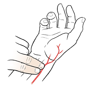 Hand palm side up showing location of radial artery. Two fingers from opposite hand taking radial pulse.